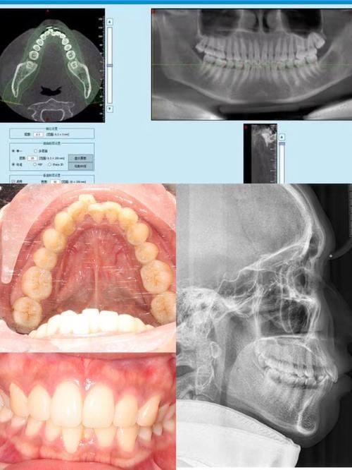江阴摩尔口腔医院(江阴店)特色项目及技术优势