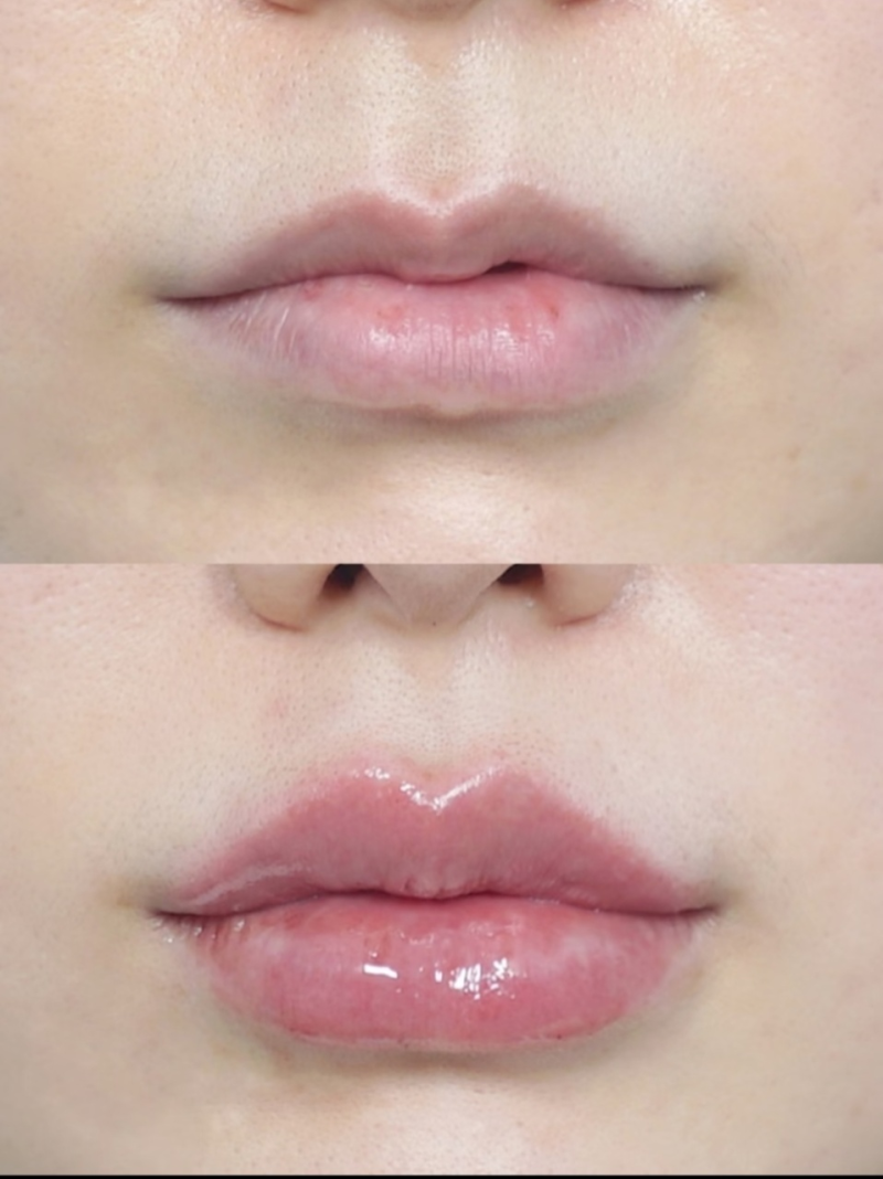 顺德港美修复医院整形美容科详细的预约挂号方式及流程