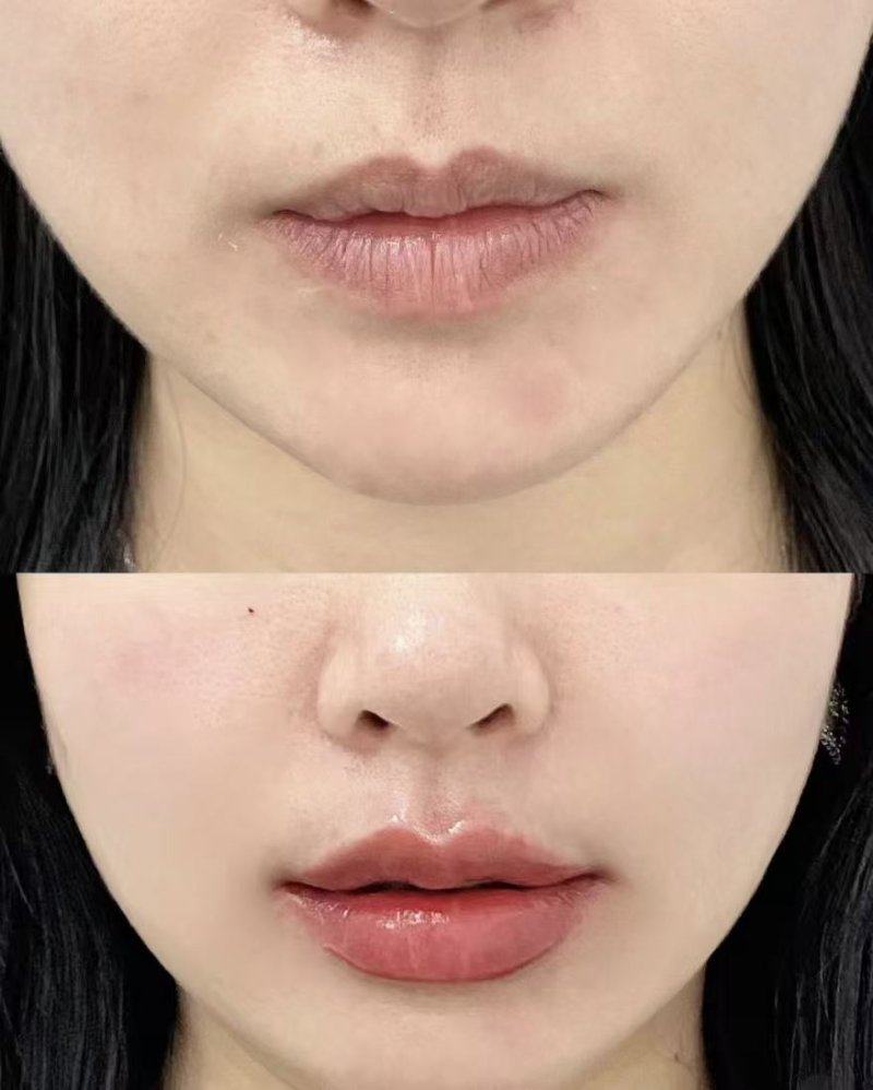 顺德港美修复医院整形美容科特色项目及技术优势