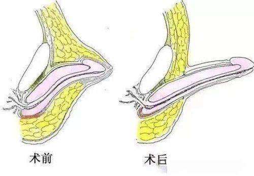 深圳南方门诊部详细的预约挂号方式及流程