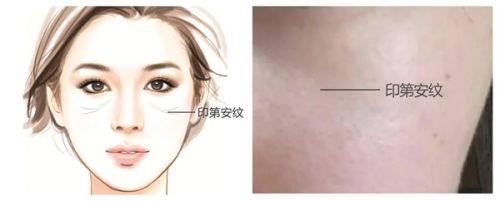 XX医院真人口碑评价怎么样？