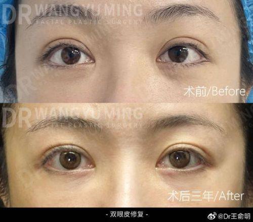 北京美尔目定慧医院医疗美容整形外科地址电话营业时间