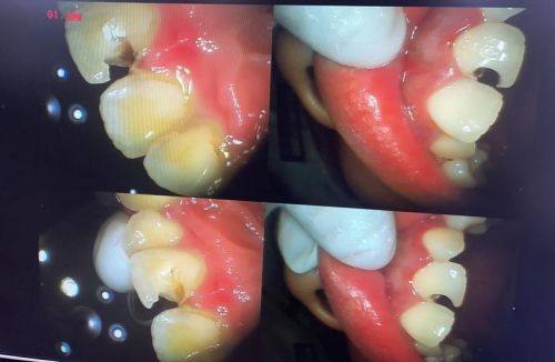 文山牙院长口腔（天伦医院口腔科）真人口碑评价怎么样？