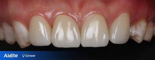 山东烟台海阳博森口腔真人口碑评价怎么样?