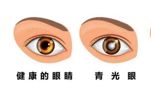 南昌大学第四附属医院眼科特色项目及技术优势