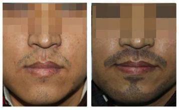 上饶记得医疗美容外科诊所(植发专科)详细的预约挂号方式及流程