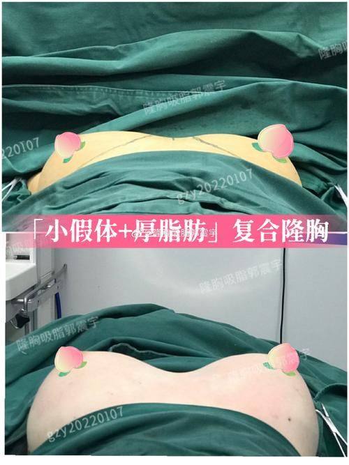 北京美尔目定慧医院医疗美容整形外科真人口碑评价怎么样？