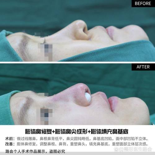 北京美尔目定慧医院医疗美容整形外科特色项目及技术优势