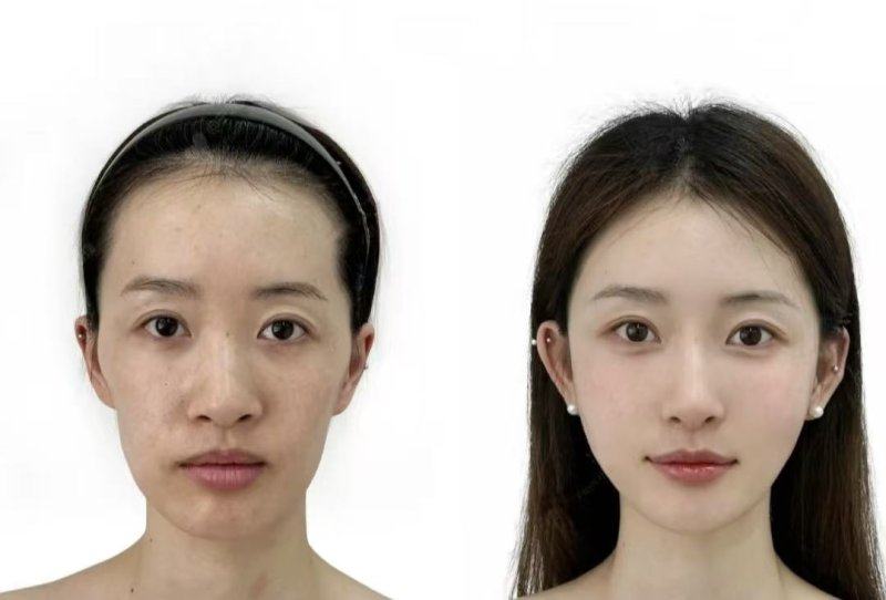 XX医院收费价格表/收费标准