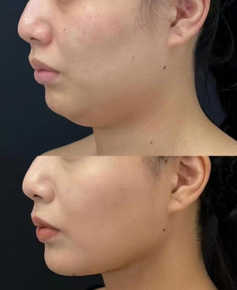 上海法思整形医疗美容门诊部真人口碑评价怎么样?