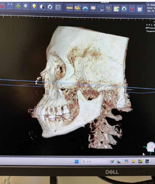 淮南东方医院集团谢一医院肿 瘤科是正规医院吗?