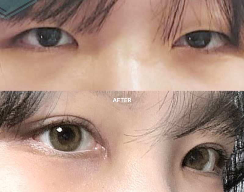 淮南东方医院集团谢一医院肿 瘤科真人口碑评价怎么样?