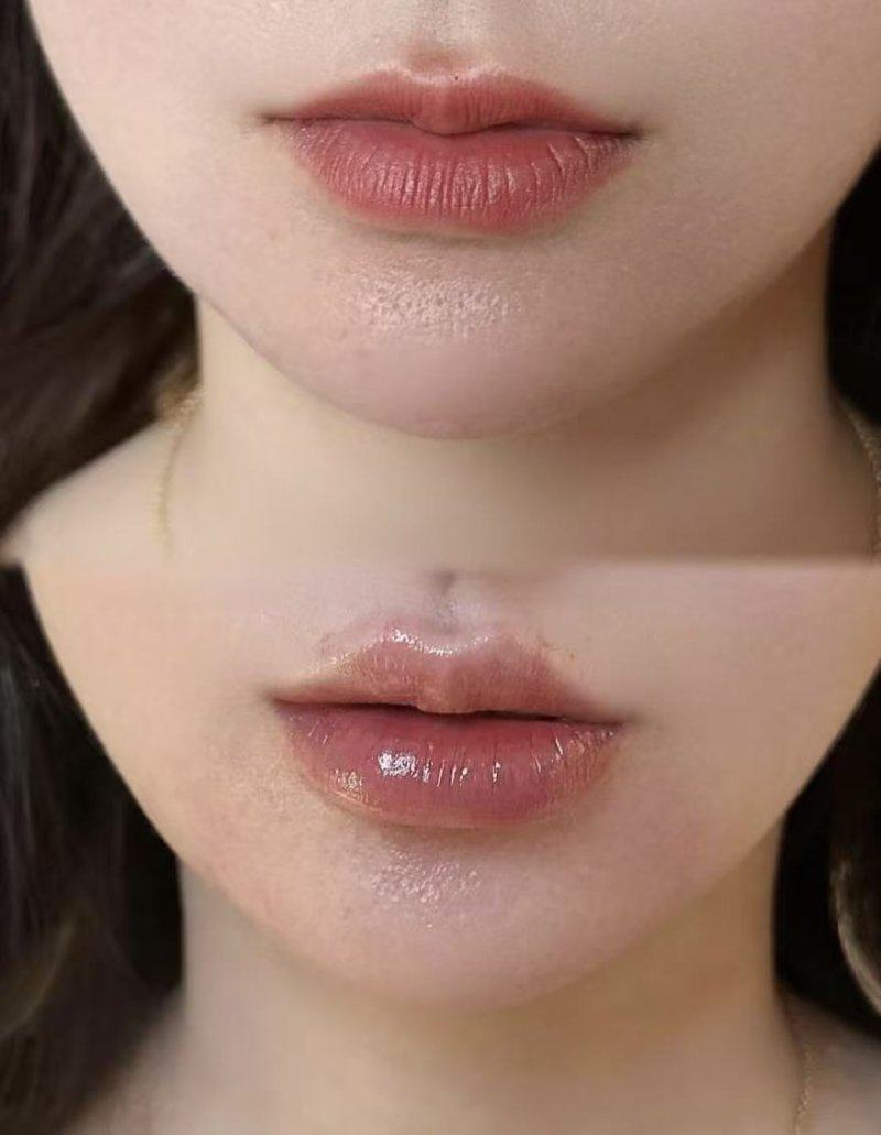 延吉蜜思医疗美容门诊部收费价格表/收费标准