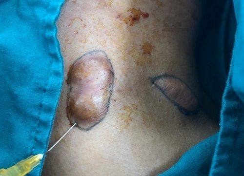 河池韦曾贵牙科诊所真人口碑评价怎么样？