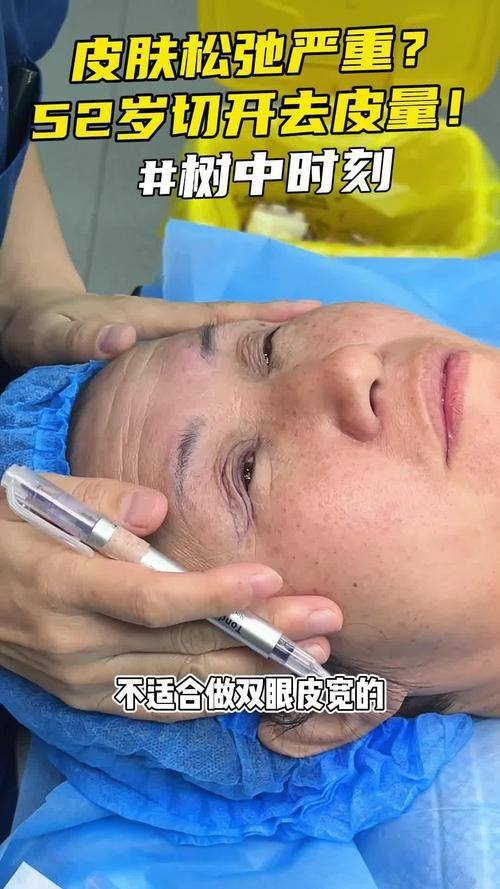 北京尚美整形医疗美容医院真人口碑评价怎么样？