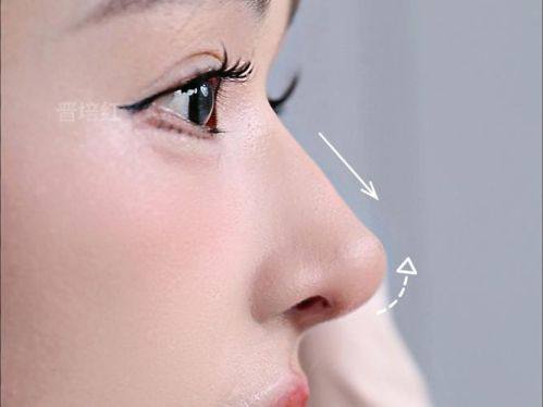 青岛华颜美医疗整形医院真人口碑评价怎么样？