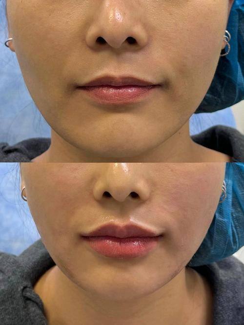 北京尚美整形医疗美容医院是正规医院吗？