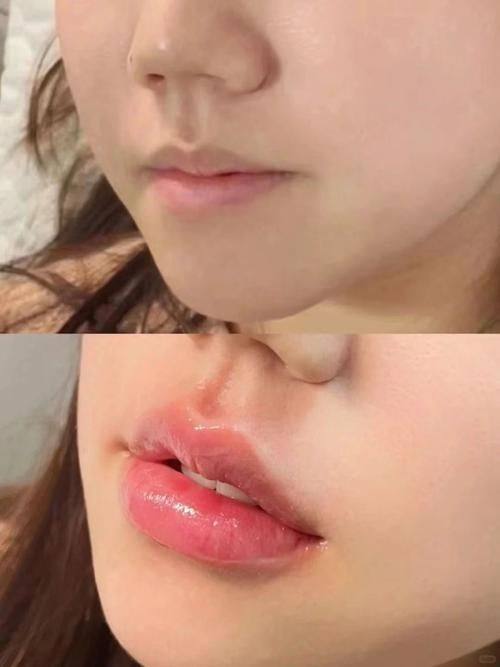 北京尚美整形医疗美容医院详细的预约挂号方式及流程