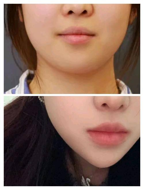 北京尚美整形医疗美容医院特色项目及技术优势