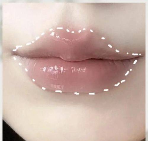 Orsayun医院真人口碑评价怎么样？