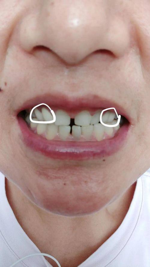 湖南郴州科尔雅口腔详细的预约挂号方式及流程