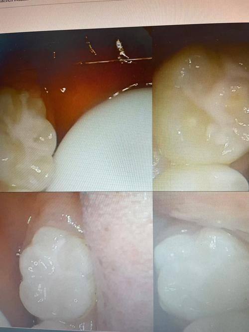 广东肇庆四会世客口腔门诊部详细的预约挂号方式及流程