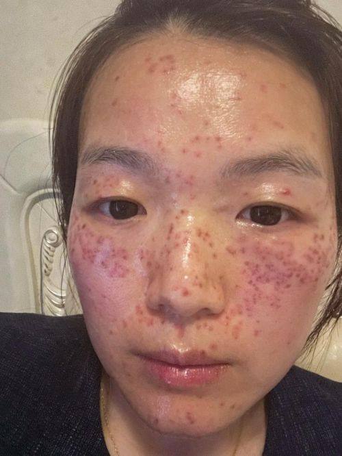 深圳悦芙医疗美容诊所特色项目及技术优势