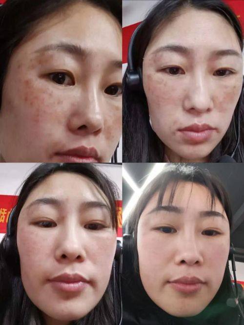 深圳悦芙医疗美容诊所详细的预约挂号方式及流程