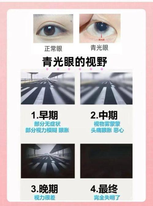 宁波市第六医院眼科医生团队实力强大及骨干医生简介