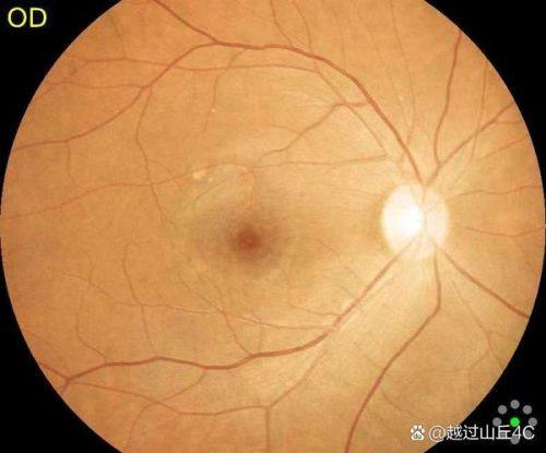 武汉爱普之光眼科医院医生团队实力强大及骨干医生简介