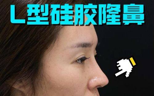 上尧星辰医疗美容门诊部特色项目及技术优势