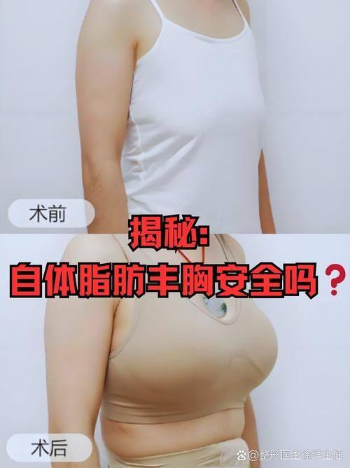 东莞整形美容医院是正规医院吗？