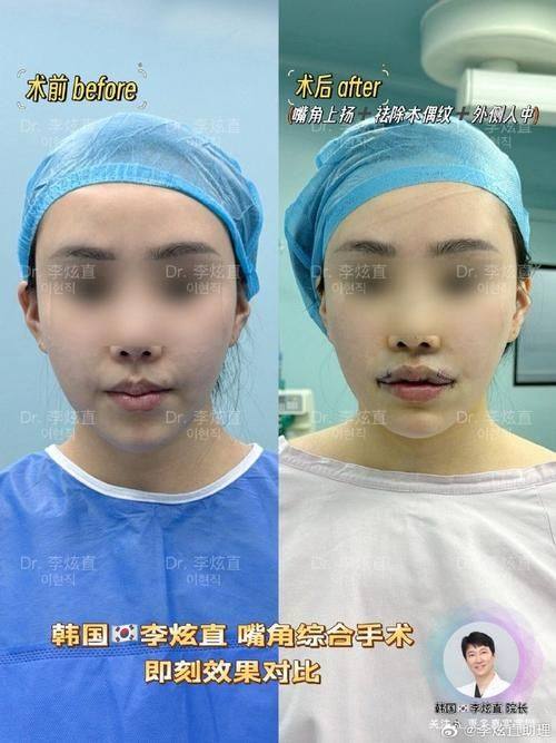 郑州诺亚医疗美容门诊部特色项目及技术优势