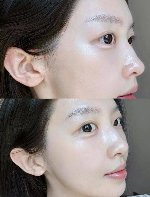 上尧星辰医疗美容门诊部真人口碑评价怎么样？