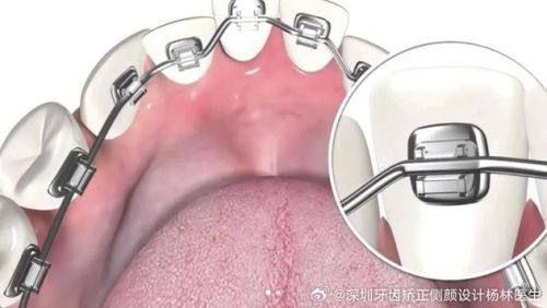 福州美齐口腔门诊部特色项目及技术优势