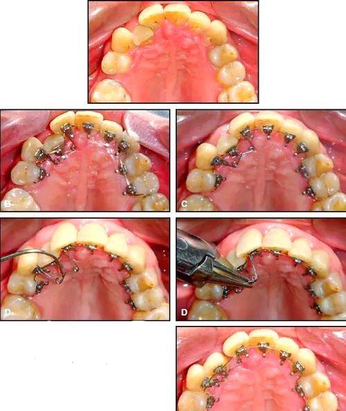福州美齐口腔门诊部真人口碑评价怎么样？
