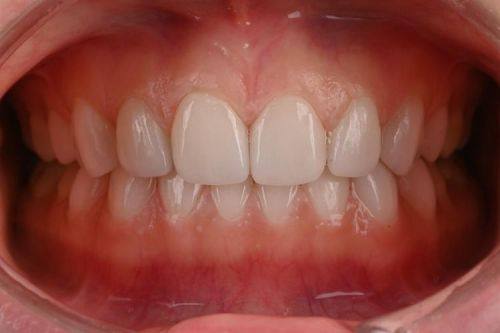 广东广州喜悦口腔特色项目及技术优势