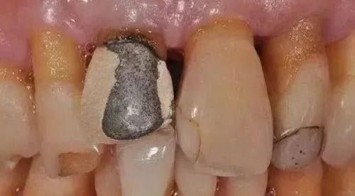 内蒙古包头银海口腔门诊部是正规医院吗？