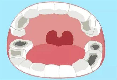 河北衡水景县博康口腔真人口碑评价怎么样？