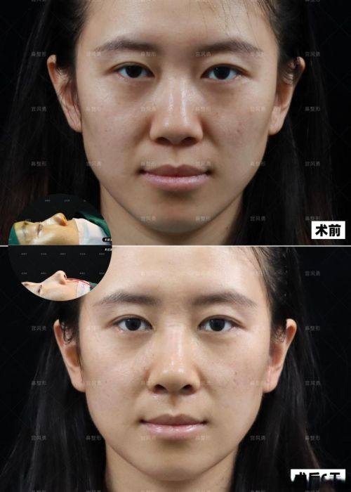 义乌阳光整形美容医院特色项目及技术优势