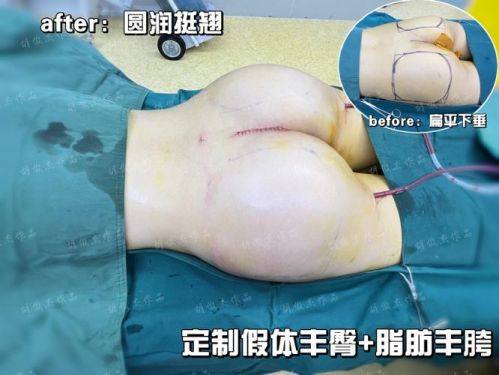 义乌阳光整形美容医院是正规医院吗？