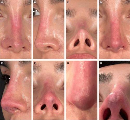 韩国tehpride皮肤科收费价格表/收费标准