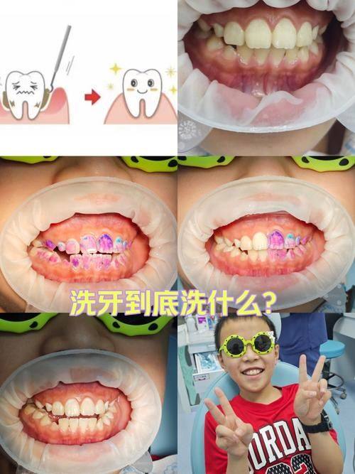 贵阳德康仁口腔门诊部收费价格表/收费标准