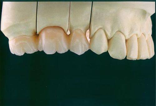 银川博诺德口腔特色项目及技术优势