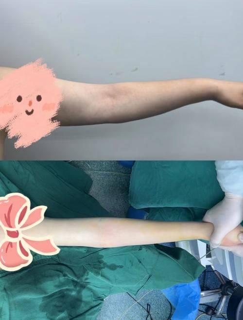 义乌阳光整形美容医院详细的预约挂号方式及流程