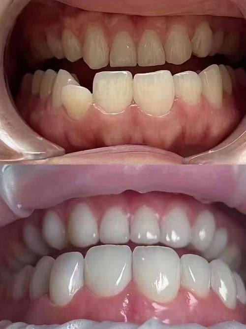 内蒙古包头银海口腔门诊部真人口碑评价怎么样？