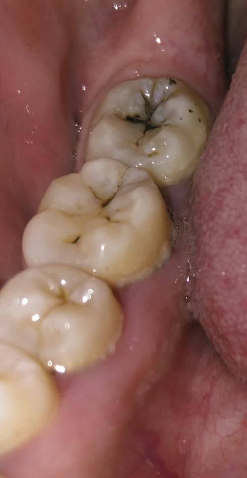 诸暨牙管家口腔门诊部特色项目及技术优势