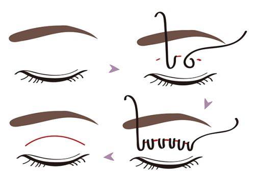 北医三院成形外科整形美容中 心收费价格表/收费标准