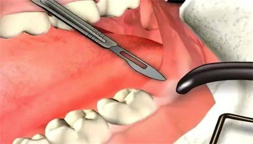 深圳市同步口腔门诊部收费价格表/收费标准