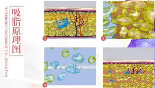 内蒙古巴彦淖尔市医院是正规医院吗？